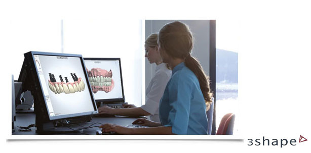 Zimmer Zfx-Abutments jetzt für 3Shape Dental System™-Nutzer