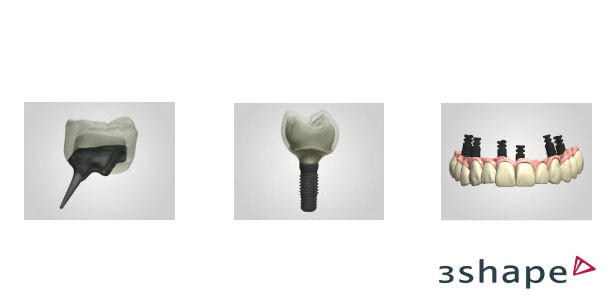 3Shape bringt das neue Dental System™ 2013 auf den Markt
