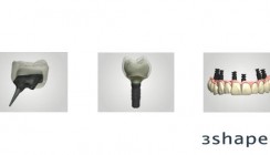 3Shape bringt das neue Dental System™ 2013 auf den Markt