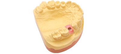 productTeaserImage