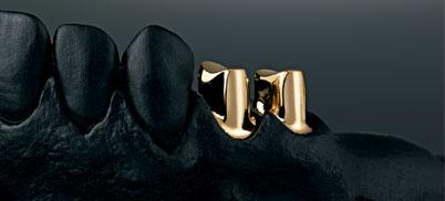productTeaserImage