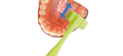 Prophylaxe in der Alterszahnmedizin