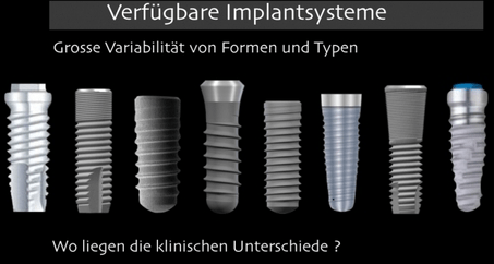 Wahl von individuellen Abutments