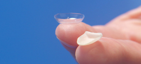 Die Lumineers "No Prep"-Technik für Keramikveneers