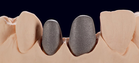 Der aktuelle Geheimtipp: Gerüstwerkstoff  Titan