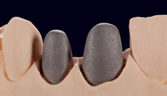 Der aktuelle Geheimtipp: Gerüstwerkstoff  Titan