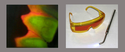 Neues Hilfsmittel zur Identifikation von Plaque entwickelt