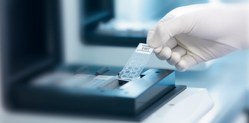 Biochips in der Parodontitisdiagnostik