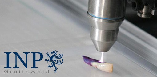 Mit Plasma auf den Zahn gefühlt