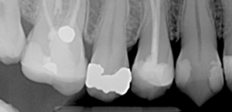 Digitale Röntgensysteme