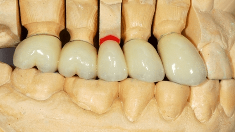 Voraussetzung oder Widerspruch?