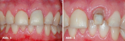 Kombination ästhetischer Verfahren