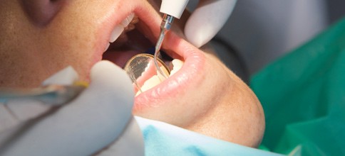 Vorbericht zu implantatgetragenem Zahnersatz erschienen