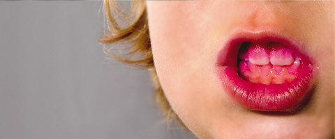 Aufklärung über "richtige" Zahnpflege - Pflicht oder Kür?