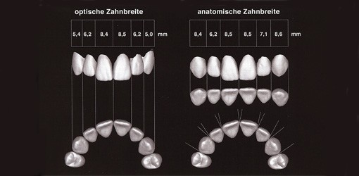 Gingivomorphometrie - Computerassistierte Beurteilung des dentogingivalen Komplexes