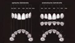Gingivomorphometrie - Computerassistierte Beurteilung des dentogingivalen Komplexes