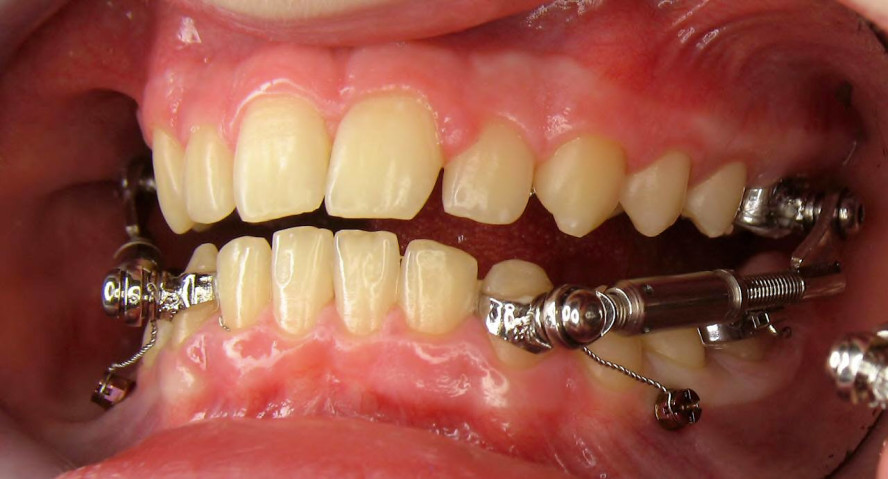 Klinische Beispiele - Teil 2