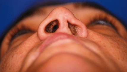 articleImage