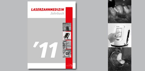Topaktuell – Das Jahrbuch Laserzahnmedizin 2011