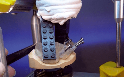 CAD/CAM-Technologie in der Implantatprothetik