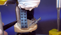 CAD/CAM-Technologie in der Implantatprothetik