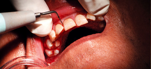 Parovakzine als Ergänzung zur klassischen Therapie