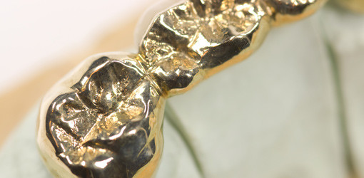 Betrügerischer Altgoldsammler