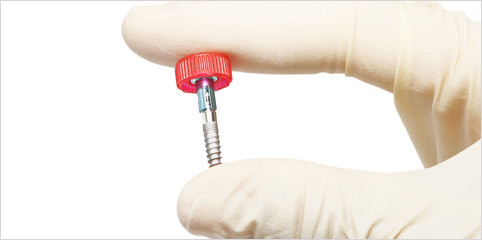 Neuartige Oberfläche für bessere Haftung von Implantaten