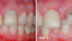 Kombination ästhetischer Verfahren