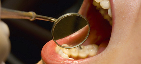 Rheuma verstärkt Parodontitis