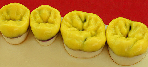 Die Kauflächengestaltung