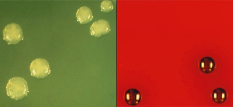 Mikrobiologische Diagnostik in der Parodontologie