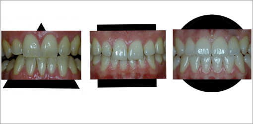 Ästhetische Richtlinien für den natürlichen Zahnersatz