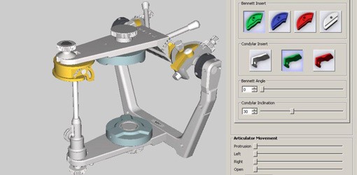 Digitale Funktionsdiagnostik ohne Abformung und Artikulator