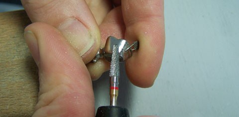 Oberflächenbearbeitung von Lasersinter-Gerüsten