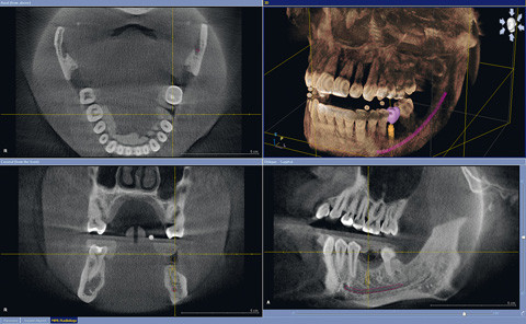 DVT bietet erstaunliche Möglichkeiten