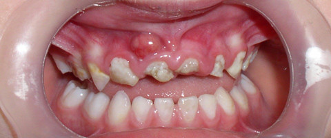 Offener Brief: Versorgung von Kindern ist gefährdet