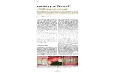 Voraussetzung oder Widerspruch? Von Rot-Weiß-Ästhetik und minimalinvasiver Implantologie