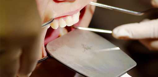 Bilddokumentation in der Implantologie