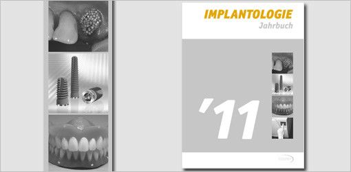 Jahrbuch Implantologie mit neuem Konzept