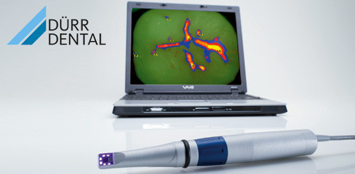 Prämierte Studie bescheinigt Fluoreszenz gute diagnostische Aussagekraft