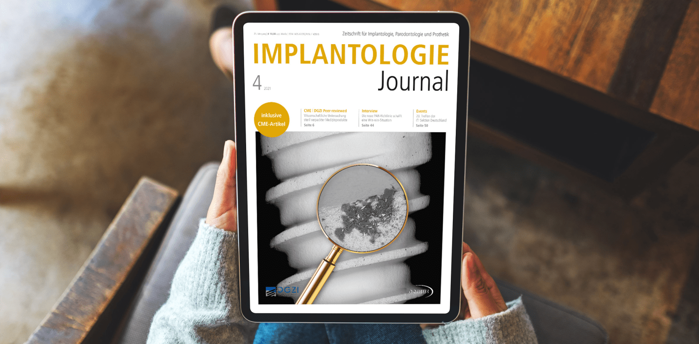 Aktuelles Implantologie Journal mit Topthema „Implantatprothetik“