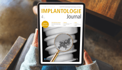 Aktuelles Implantologie Journal mit Topthema „Implantatprothetik“