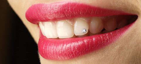 Twinkles, Dazzler, Grillz - Körperschmuck in der Zahnarztpraxis