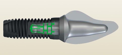 Heraeus stellt Vertrieb seines Implantatsystems IQ:NECT ein