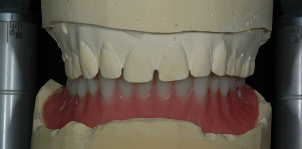 HandWerk – Garantiert CAD/CAM-frei