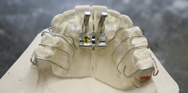Die labortechnische Herstellung der Vorschubdoppelplatte