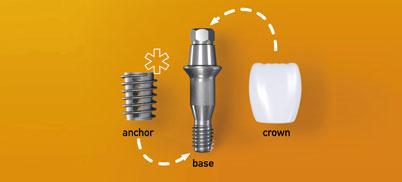 productTeaserImage