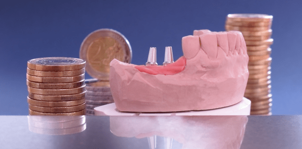 Die bestmögliche Abrechnung bei Implantaten