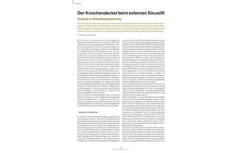 Der Knochendeckel beim externen Sinuslift - Ein Ansatz zur Behandlungsoptimierung